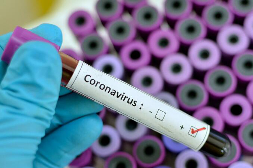 Son sutkada Azərbaycanda COVID-19 infeksiyasına 12 yoluxma faktı qeydə alınıb