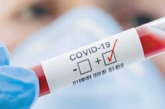 Son sutkada Azərbaycanda COVID-19 infeksiyasına 34 yoluxma faktı qeydə alınıb
